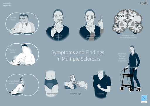 05_Hegasy_Multiple_Sclerosis_Wiki_EN_CCBYSA