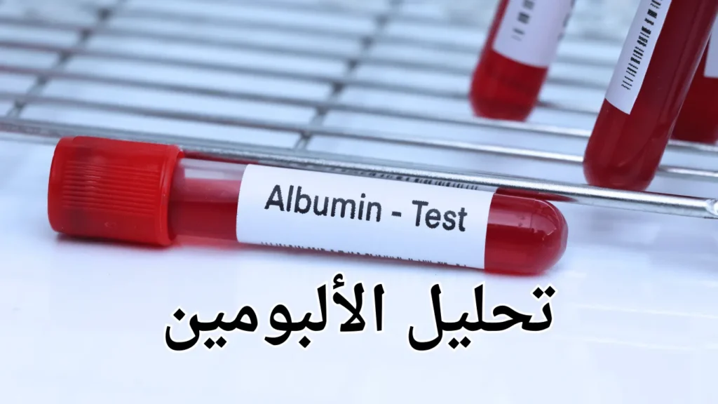 تحليل الألبومين في الدم