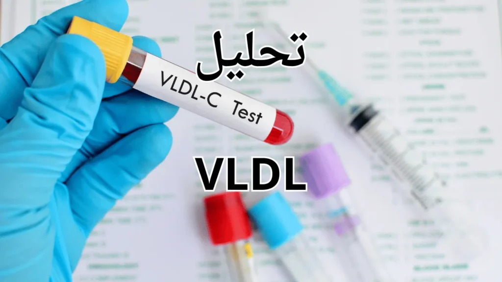 تحليل VLDL
