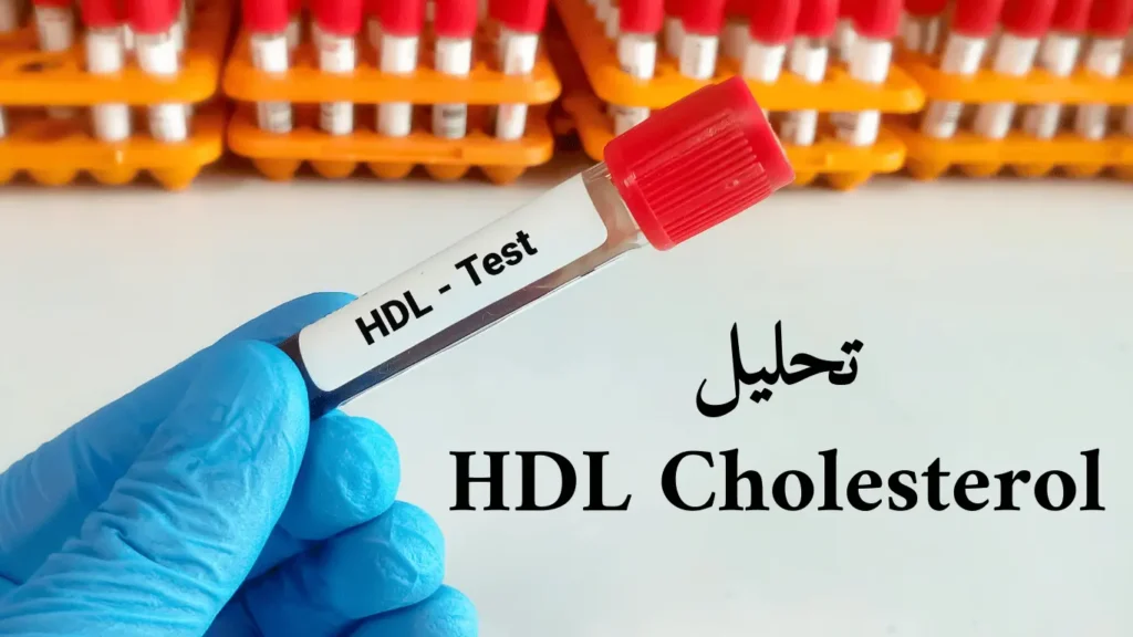 HDL Cholesterol